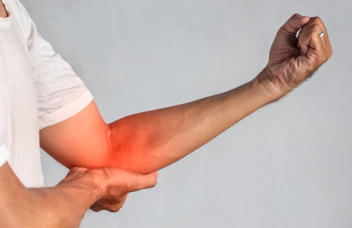 Golfer’s Elbow