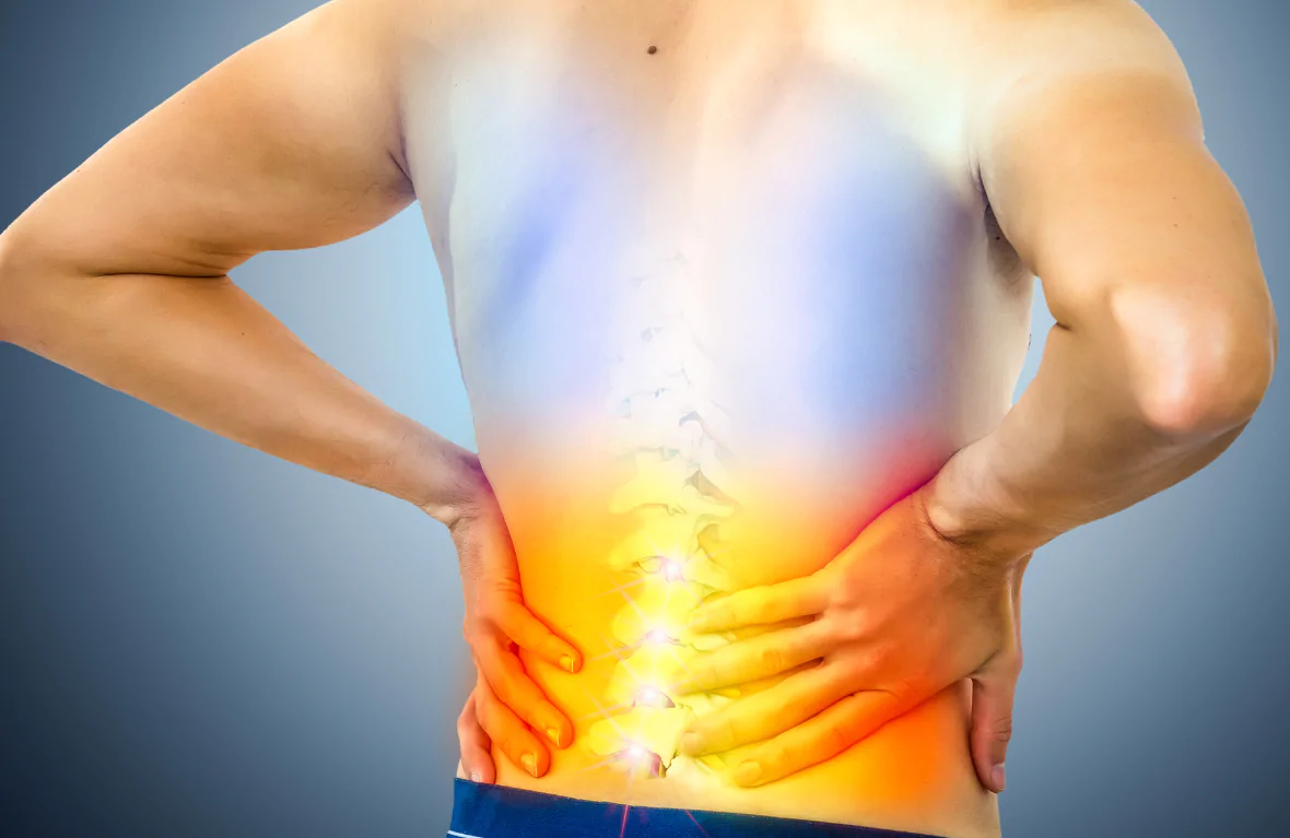 Sciatica