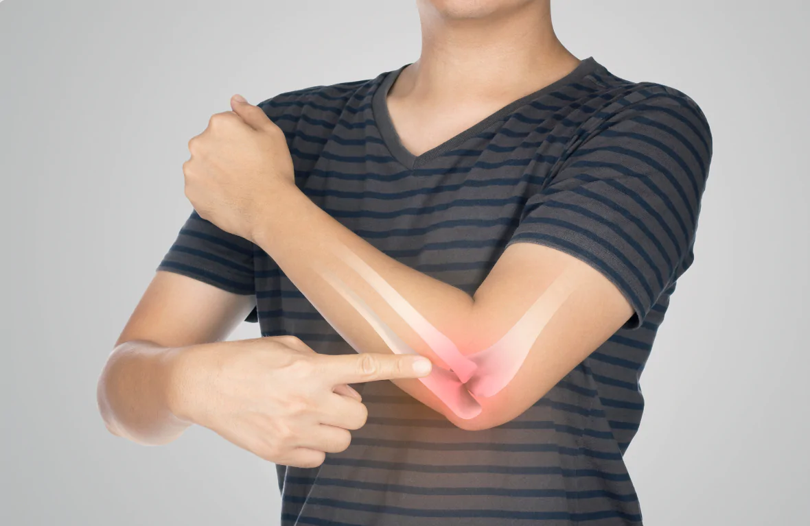 Tennis Elbow