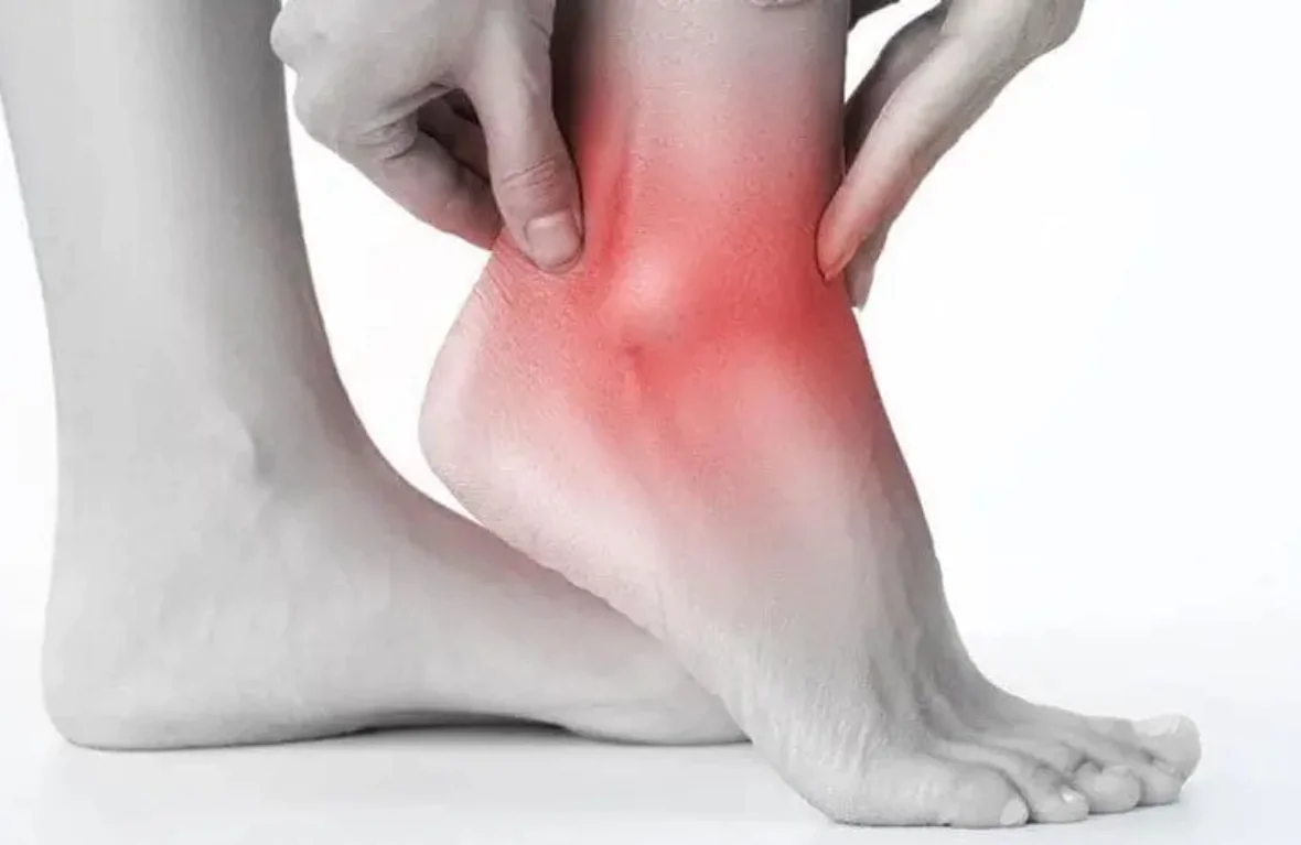 Ankle Pain