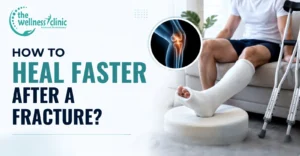 How to Heal Faster After a Fracture?